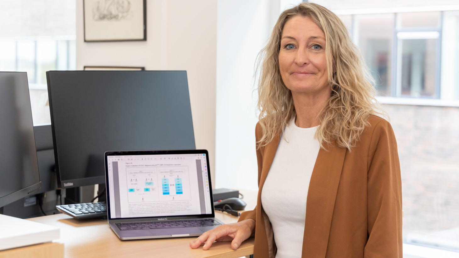 Foto af Anne Hammer, lektor, overlæge, ph.d.